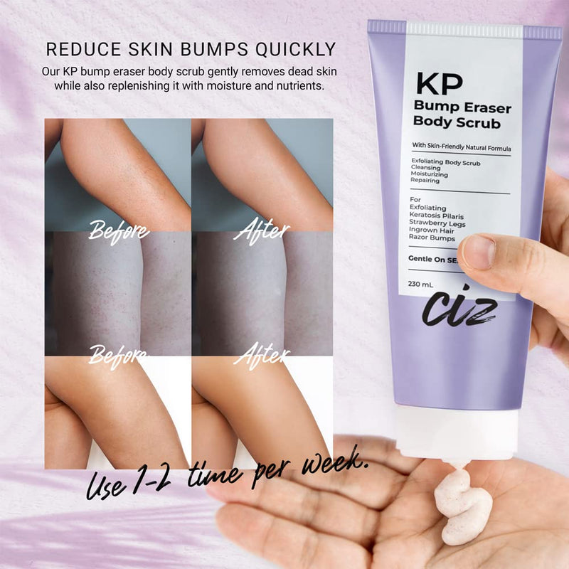 [Australia] - KP Bump Eraser Body Scrub: Exfoliating Keratosis Pilaris, Strawberry Skin Treatment - Smooths Rough, Bumpy, Dry Skin on Arms, Legs, Buttocks - KP Scrub Wash Helps Reduce Ingrown Hair Bumps 1 Pack 