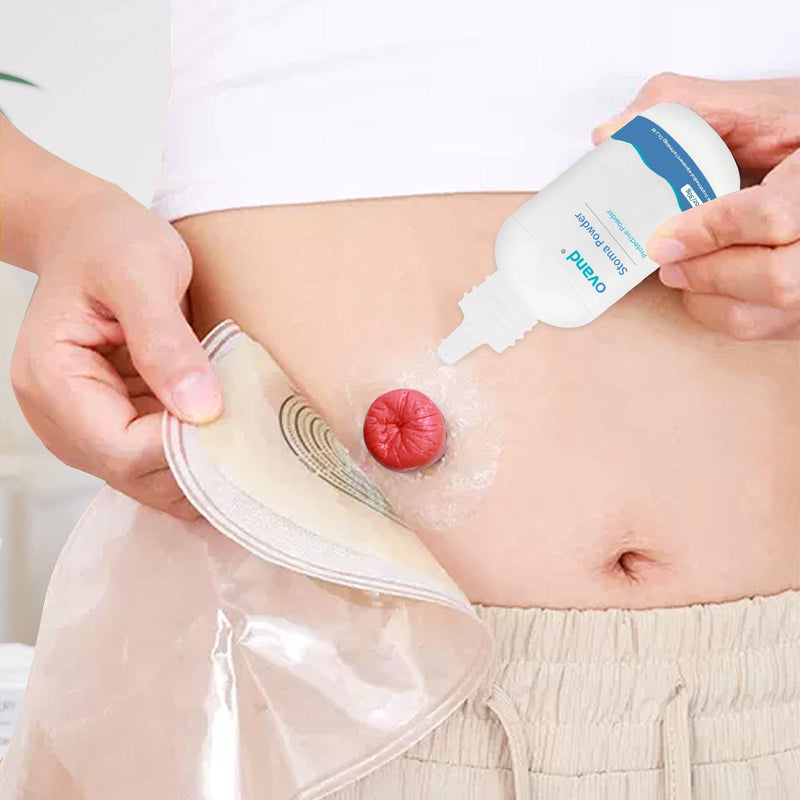 [Australia] - 30g Stoma Powder, Ostomy Skin Care Powder, Protects Skin Keep Dry Ostomy Powder Stoma Powder（4 Boxes） 