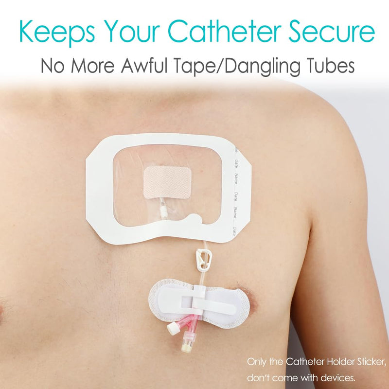 [Australia] - Low-Profile Catheter Stabilization Device for Kids Baby's Gtube Feeding Tube G J Tube Peg Pd Catheter Holder Peritoneal Dialysis Accessories Adhesive Patch Dressing (Pack of 10) Small 10 Pcs 