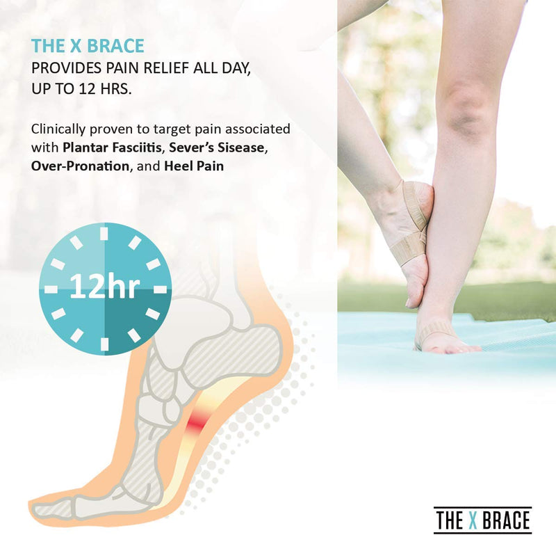 Tuli's X Brace, Arch Support Brace and Compression for Sever's Disease, Plantar Fasciitis, Heel Pain, Flat Feet, Fallen Arches, and Over-Pronation, 1 Pair, Small Beige