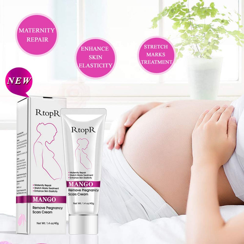 [Australia] - Mango Stretch Marks and Scar Cream, Stretch Marks and Scar Removal Cream for Pregnancy, Stretch Marks Scar Belly Creams for Wrinkles, Obesity Fat Stretch Mark Moisturizing, Remove Marks (40g) 