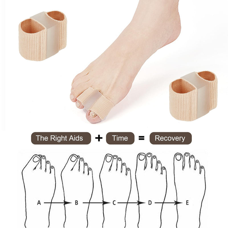 [Australia] - Pack of 2 tubular bandages, silicone toe stretcher, hallux valgus correction, gel big toe spacer with 2 loops, double hole toe orthosis for bunion pain and overlapping toes, women and men 