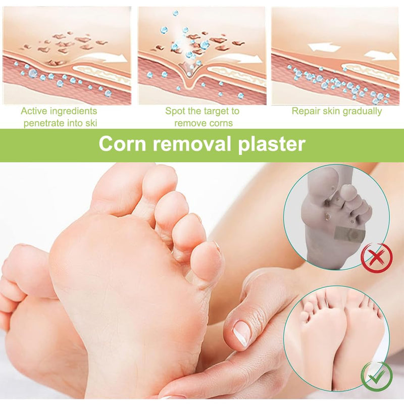 [Australia] - Corn plaster, 30 pieces corn removal pads, corn removal plaster, corn removal on the sole of the foot, corn remover pads, corn removal plaster 
