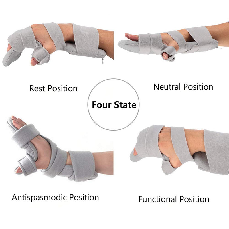 Milltrip Functional Resting Hand Splint, Stroke Hand Brace for Flexion Contractures, Hand Fractures, Wrist Sprains, Carpal Tunnel Syndrome, Hand Nerve Injury - Right