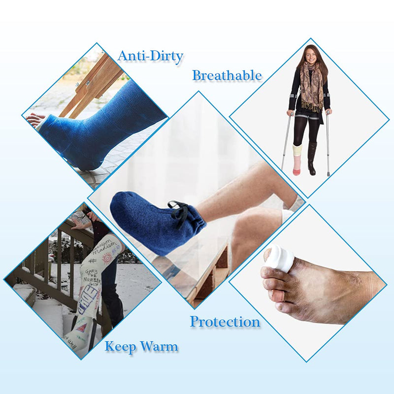 Cast Toe Sock Cover for Foot Ankle Cast, Warm Plaster Stocking Protective Accessories, Breathable & Adjustable, 1 Pcs (S) S