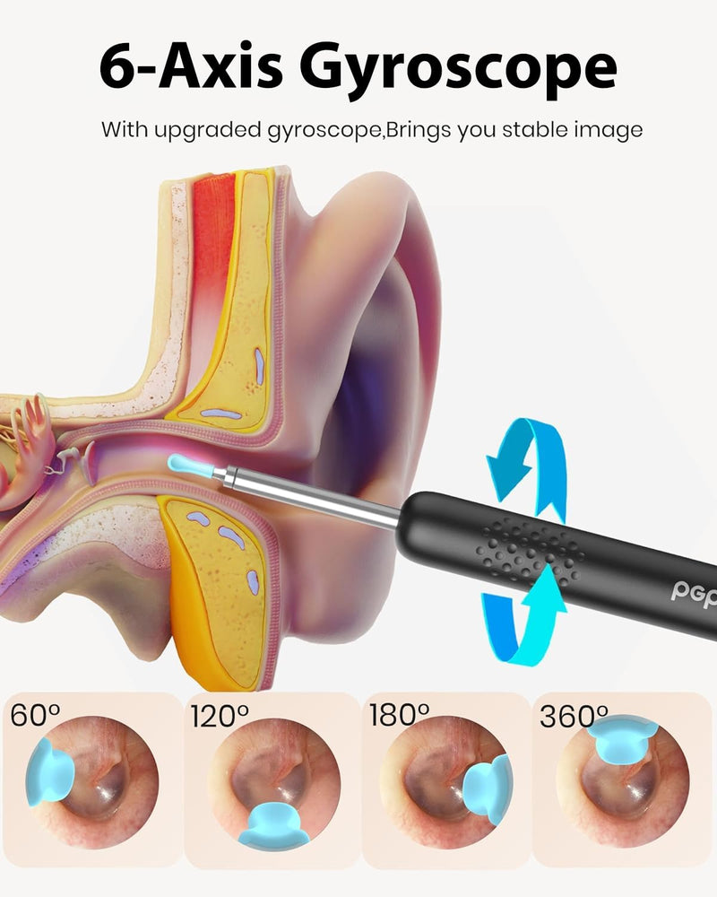 [Australia] - BEBIRD R1 Ear Wax Removal Tool - Spade Ear Cleaner with Ear Camera, 1080P Ear Scope, Earwax Remover Picker with 10 Replacement Tips Ear Pick with 6 LED Light for Earwax Cleaning, Support iPhone, Black 