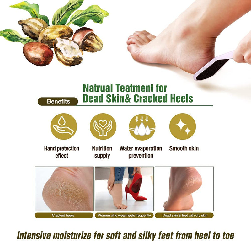 [Australia] - Epielle Hydrating Hand & Foot Masks 12 Pairs, Deep Moisturizing Socks & Gloves, Soften Dry Hands & Cracked Heels with Shea Butter & Jojoba Oil, Korean Skin Care, Foot Spa, Self Care Gifts for Women Hydrating Socks & Gloves 
