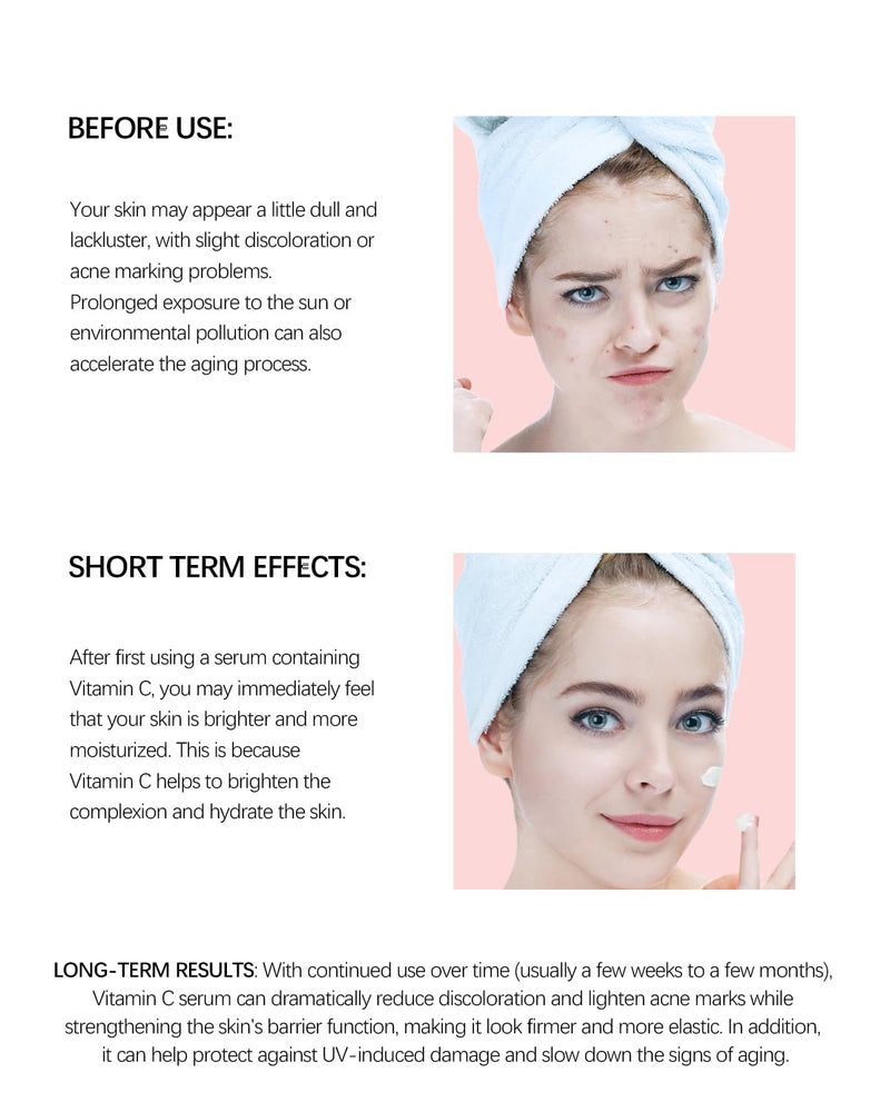 Vitamin C Serum for Face with Hyaluronic Acid iacinamide, Salicylic Acid & Lemon Extract, Brightening Serum For Dull 1FL OZ(30ML)