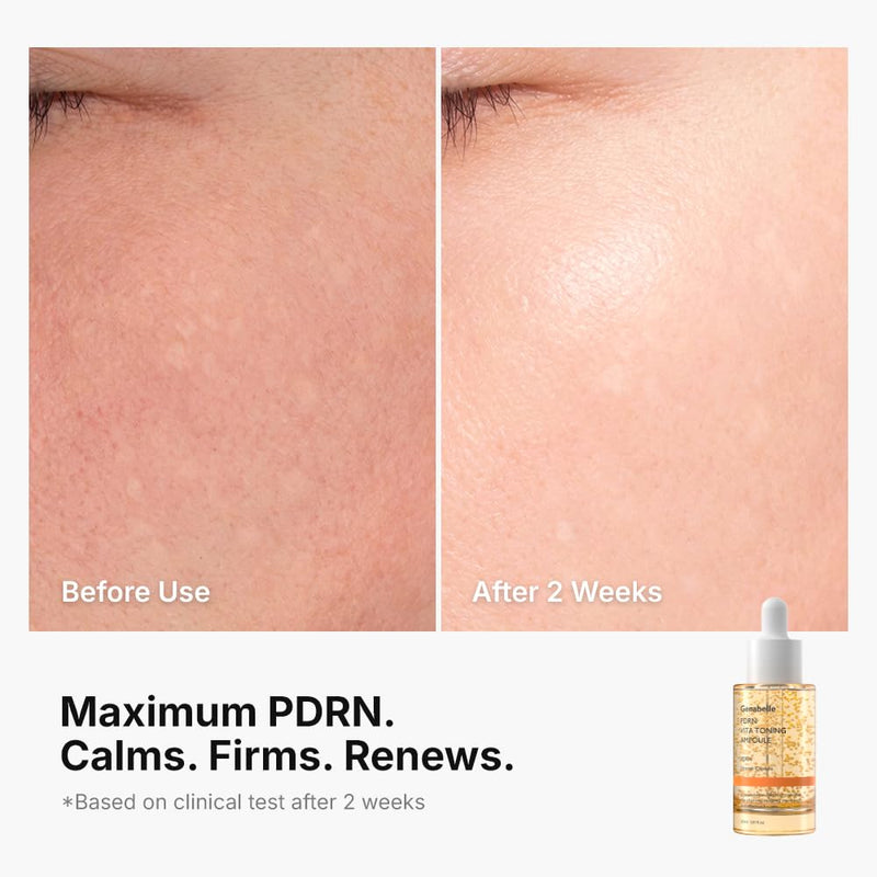 Genabelle PDRN Vitamin C Serum Toning Ampoule - Lightweight Glass Skin,korean skin care with Vitamin B, C, E, PDRN, Serum for Blemishes, Glass Skin, Fine Lines and Rough Skin Texture, 1.01 fl oz 1.01 Fl Oz (Pack of 1)