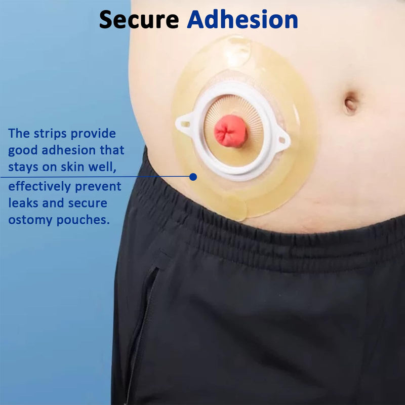 [Australia] - 30PCS Ostomy Barrier Strips, Medical Hydrocolloid Ostomy Supplies, Elastic Barrier Strips, Waterproof Leak-Free Skin Adhesive Barrier Tapes for Stoma Colostomy Bags 