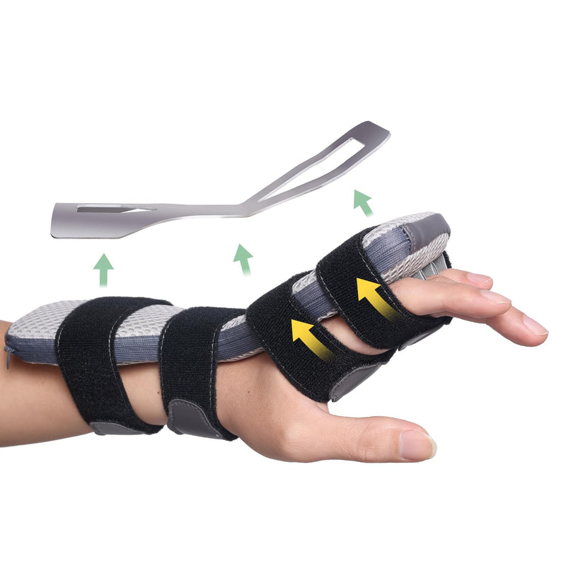 Radial Nerve Palsy Splint for Wrist Drop, Adjustable Static Fingers Fixation Brace, for Crutch Palsy, Limp Finger, Mcp Arthroplasty, Stroke Hand Recovery - Fits Right & Left Hand
