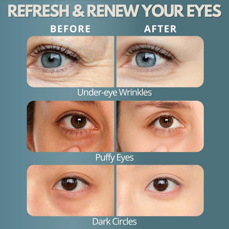 Under Eye Red Light Therapy, Rechargeable Eye Massager for Dark Circles Under Eye Bag Puffy Wrinkles Fine Lines