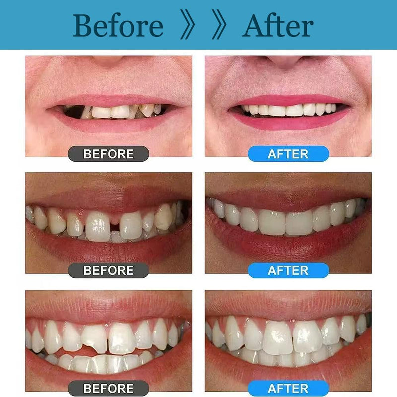 [Australia] - Tooth Repair kit with 4 Dental Tools, Easy-to-Use for Men & Women,Dental Care Kit Fixing Broken Teeth, Save Smile Cause Bad Teeth and Smile Confidently Again 