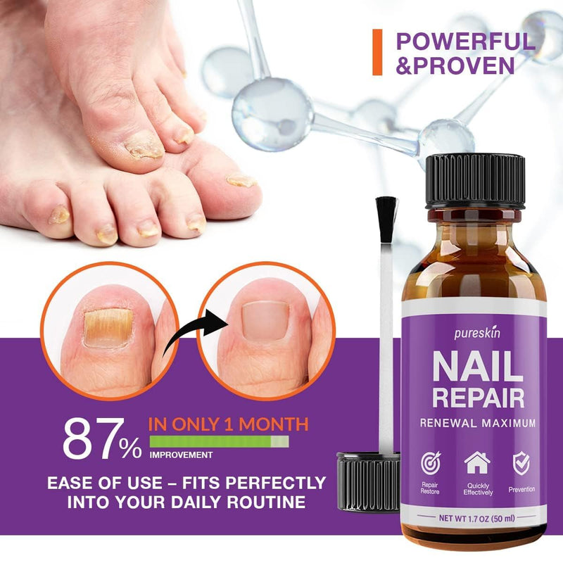 [Australia] - Toenail Fungus Treatment Extra Strength for Toenails and Fingernail Discoloration 1.0 Oz Drop 1 Fl Oz (Pack of 1) 