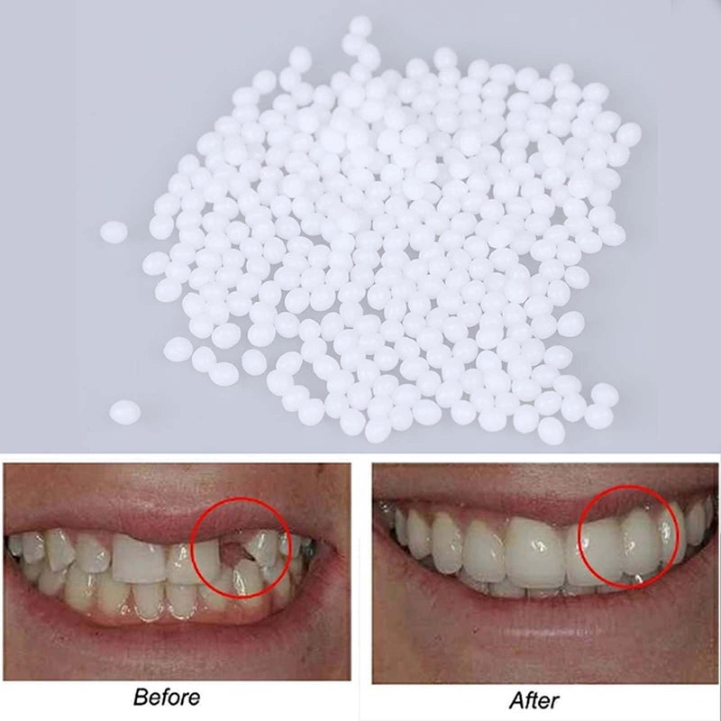 [Australia] - 2 Pairs, Regain Confidence Smile for Women and Men, Temporarily Adjustable(Yellow) Yellow 