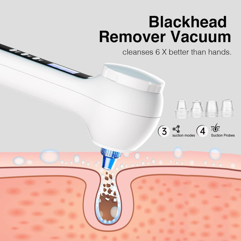 [Australia] - Face Scrubber Exfoliator with LCD Screen,Rechargeable Facial Cleansing Brush IPX7 Waterproof 3 in 1 Blackhead Remover Vacuum for Exfoliating,Massaging and Deep Pore Cleansing White 
