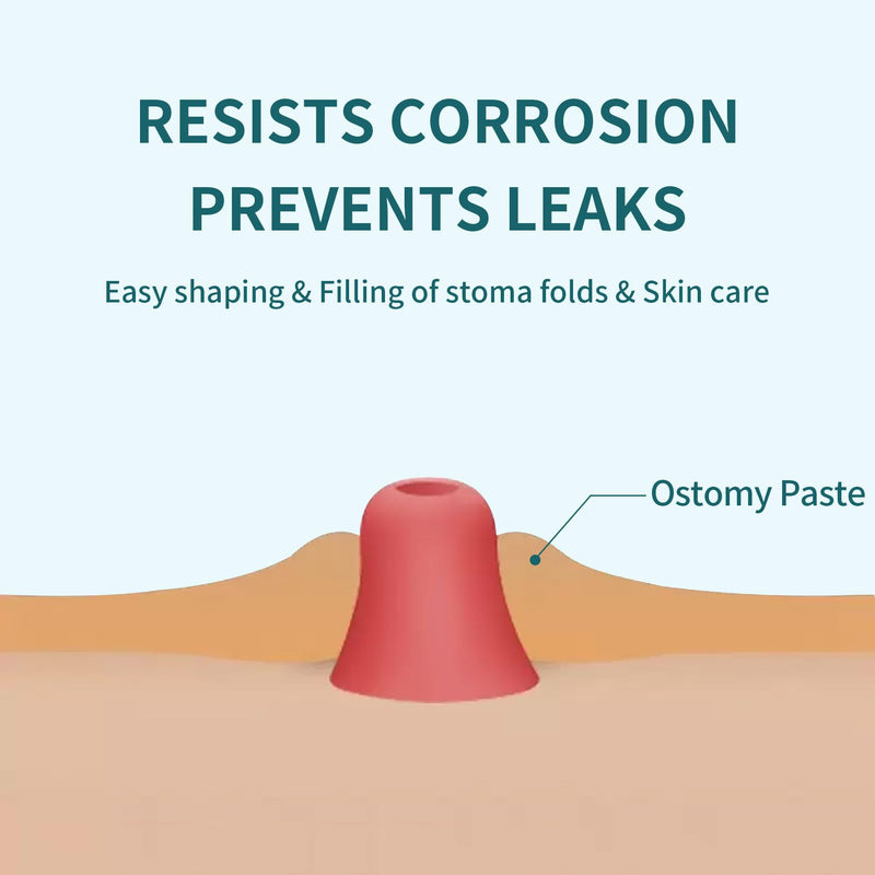 [Australia] - Ostomy Paste, No-Sting Skin Barrier Paste, Ostomy Filler Paste for Ostomy-Colostomy-Ileostomy, 2.1 Oz Tube (4 Tube) 