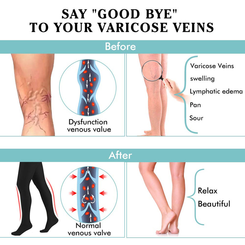 [Australia] - Compression Pantyhose Women 20-30 mmHg Stockings for Varicose Veins (Black, S) 