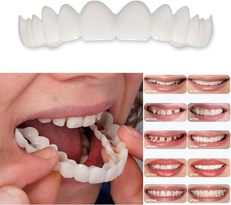 2 Pairs, Nature and Comfortable Regain Confidence Smile,Temporarily Adjustable for Men and Women.(White) White