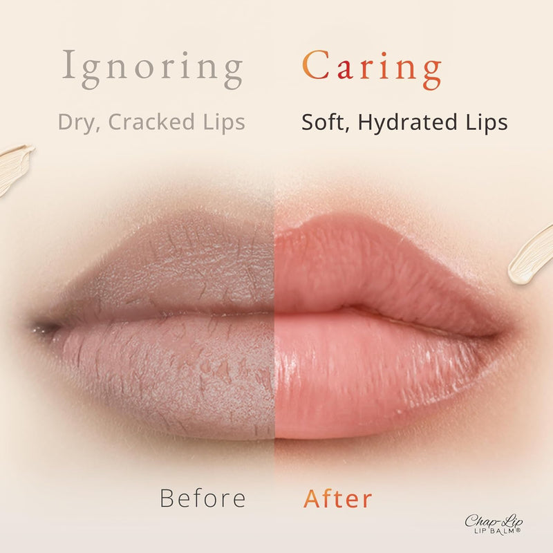 CHAP-LIP Lip Balm 48 Ct. with Fruit Flavors, Cocoa Butter, Coconut Oil Dermatologist Tested Moisturizing Vitamin E & Total Hydration Treatment & Soothing Lip Therapy 100% natural Made In USA 48 Count (Pack of 1)