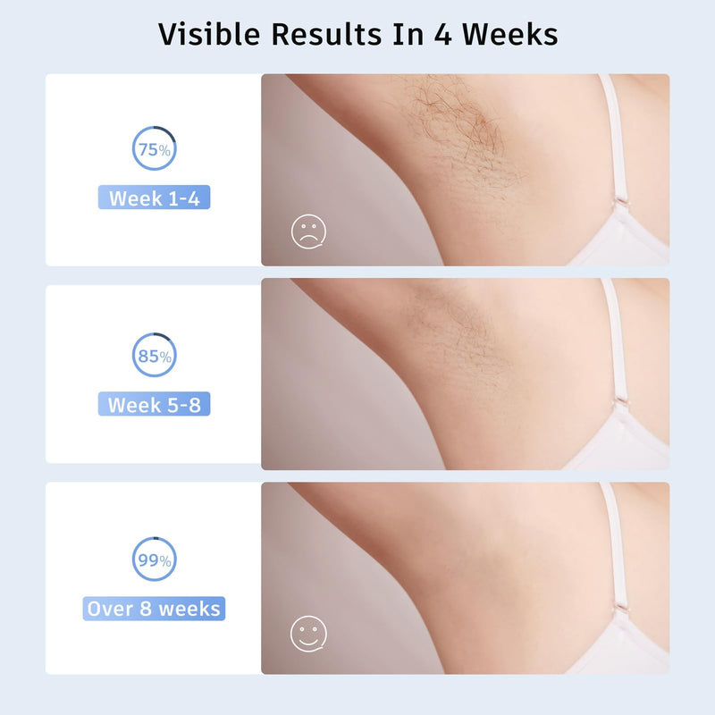 [Australia] - Laser Hair Removal,Laser Hair Removal for Women, 999999 Flashes,Hair Removal Device,ipl laser hair removal for Facial Legs Arms Whole Body Use (White-Rose Gold) 