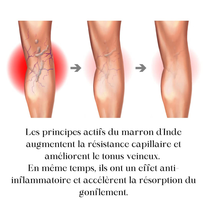 [Australia] - Green idea | HORSE CHESTNUT OIL for varicose veins, hemorrhoids, severe leg syndrome | Vein protective effect | with horse chestnut seed and flower extract - hemorrhoid oil 100 ml 