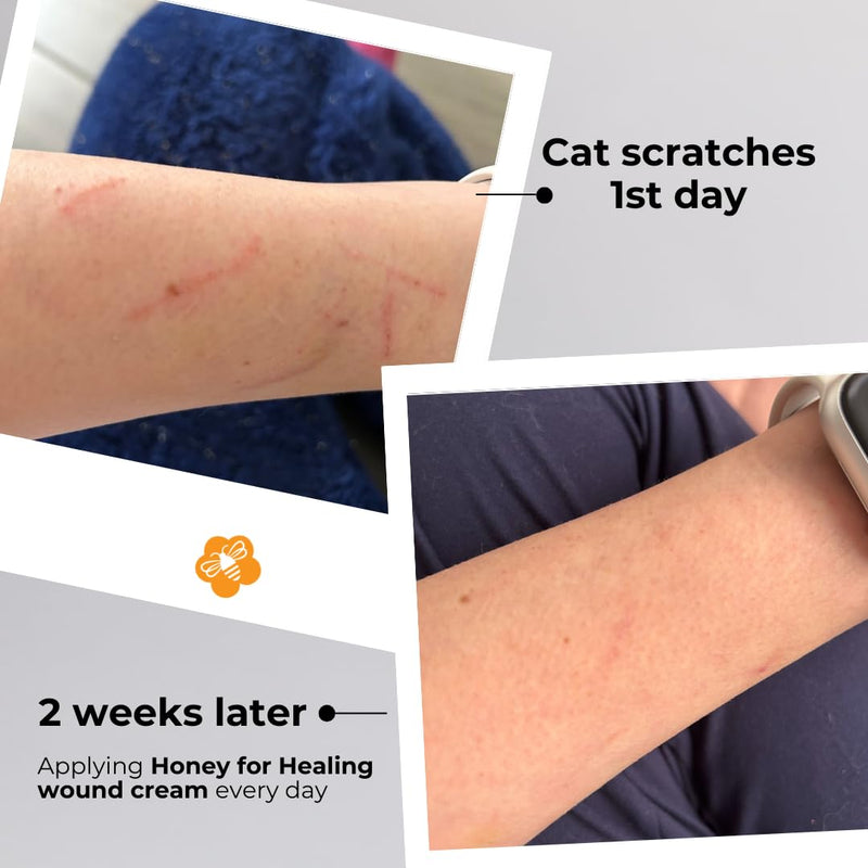 [Australia] - Manuka Honey Wound Cream with UMF 15+, Fast-Absorbing, Non-Sticky Formula for Cuts, Burns, Scrapes, Minor Injuries ‚Äì 1.75oz / 50 g 