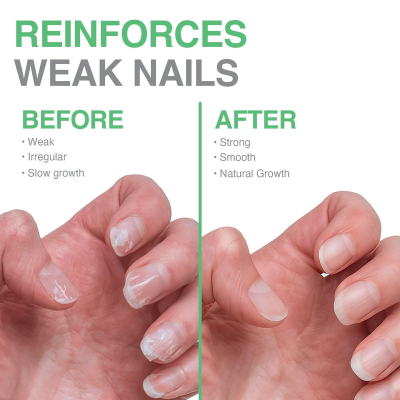 Probelle Nail Maintenance Formula 2, Nail Hardener and Strengthener for soft, brittle, and splitting nails - Reinforces, protects, conditions, strengthens, grows fingernails 5 fl oz/ 15 mL 0.5 Fl Oz (Pack of 1)