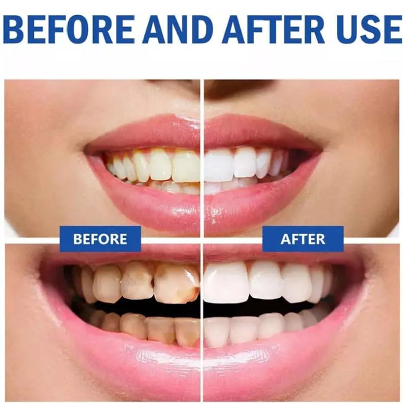 [Australia] - SP 10 Probiotic Whitening Toothpaste, Natural Oral Care with Probiotics for Whiter Teeth, Fresh Breath & Gum Health 3.53 Ounce (Pack of 2) White 