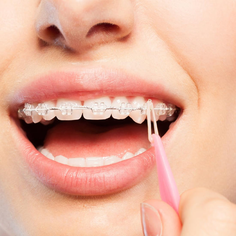 [Australia] - WeddHuis 8pcs Orthodontic Elastic Disposable Plastic Braces Braces Material Placement Removal Tools Elastic Rope Hook 