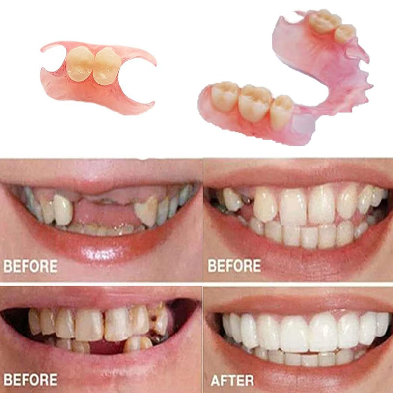 [Australia] - Tooth Repair Kits DIY for Making Temporary Partial or Full Dentures,Tooth Fixing Kit for Improving Condident Smile 