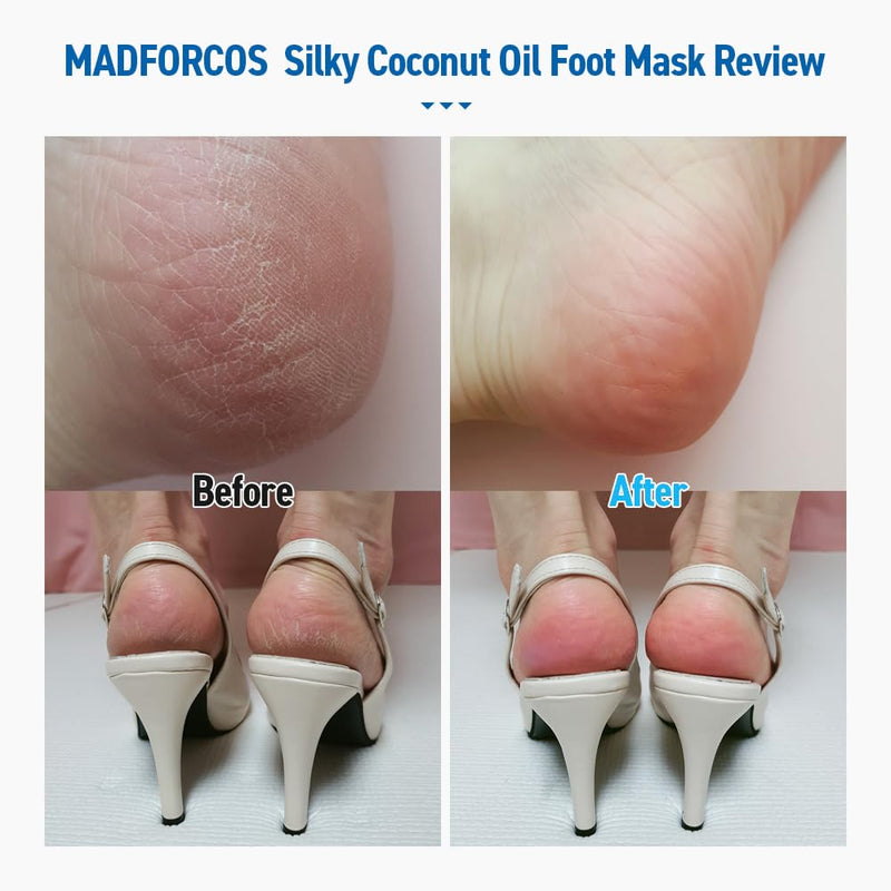 [Australia] - Silky Coconut Oil Foot Mask – 5 or 10 Pairs Hydrating Booties for Dry, Cracked Feet | Nourishing, Moisturizing & Walkable | Spa Foot Treatment at Home (10 Pair (Pack of 2)) 5 Count (Pack of 2) 