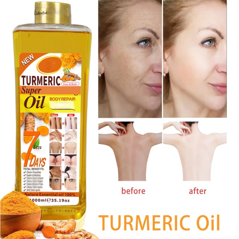 Vitamin C Body Oil, 1000ml Tumeric Body Oil, Retinol Vitamin C 7days, Vit C Body Corrector Oil for Uneven Skin Tone (1000ML VC) 1000ML VC