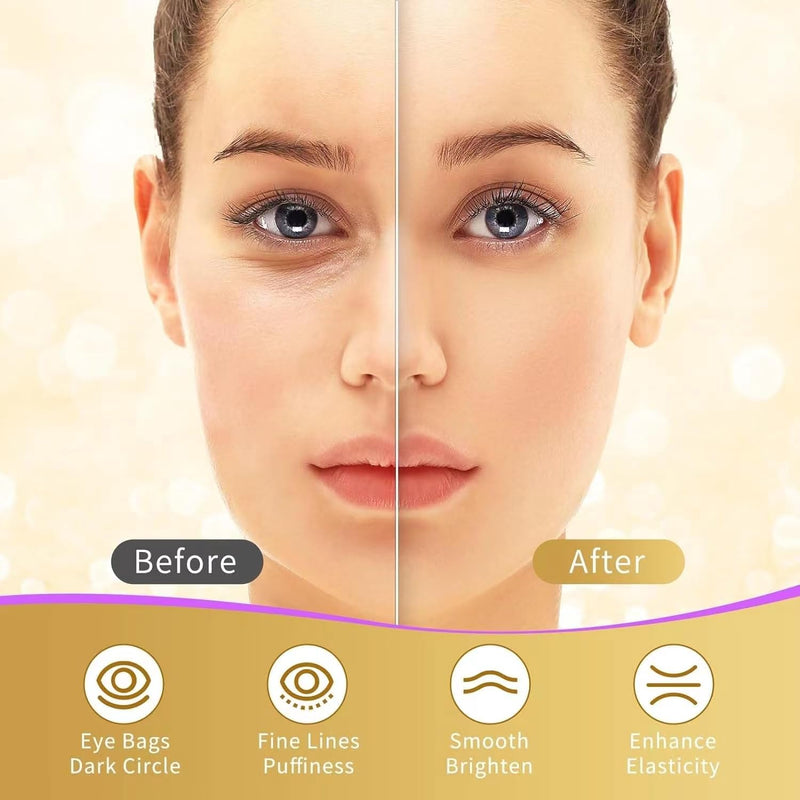 [Australia] - Under Eye Patches, 40 Pairs Eye Mask for Dark Circles, Puffy Eyes, Undereye Bags,Wrinkles,Eye Mask Patches with 24K Gold, Hyaluronic Acid,Rose & Aloe Vera, Eye Treatment Skin Care for Men & Women Gift 24K Gold,Pink,Blue,Green 