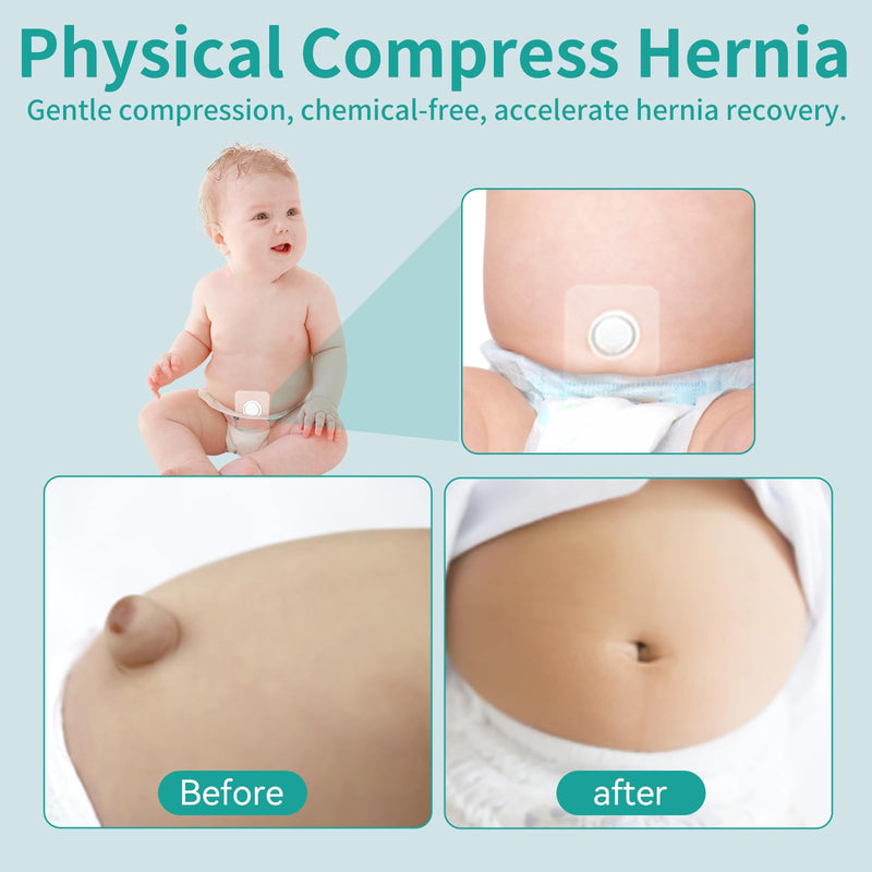 [Australia] - Baby Belly Navel Patches, Belly Button Shaper with Cotton Pads, Baby Umbilical Hernia Patch Waterproof, Infant Essentials Must Haves (7 PCS 10 * 10CM) 7PCS 
