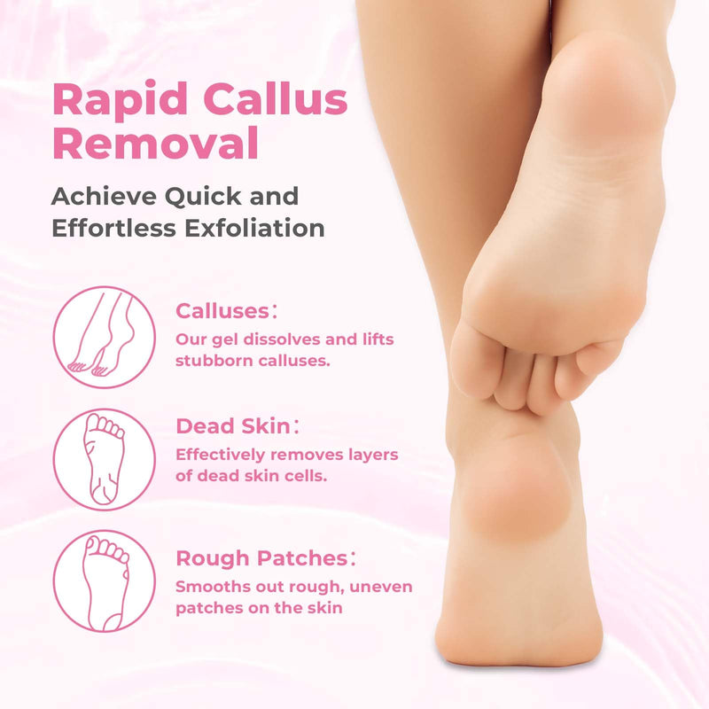 [Australia] - Foot Callus Remover with Foot File, Extra Strength Callus Remover Gel with Brush Head, Professional Dead Skin Removal for Feet, 8oz 