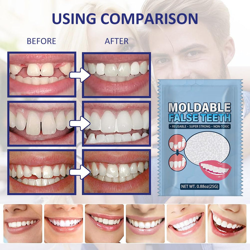 [Australia] - Temporary Dentures, Dentures Prosthesis, Temporary Tooth Repair Kit, Temporary Tooth Repair Kit, Vampire Fake Dentures, for Halloween, Cosplay, 25g 