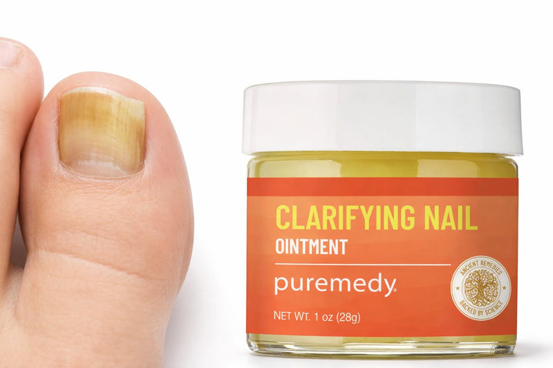 Puremedy - Clarifying Nail Ointment - All Natural Salve for Healthy Nails, Helps with Yellow Nails and Skin - 1 oz