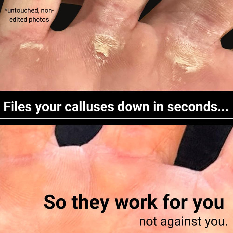 [Australia] - Original Callus File - Precise Callus Remover for Peak Performance - Callus Maintenance Kit - includes Hydrating Callus Salve - for Gym Enthusiasts, Climbers, Gymnasts & WOD Junkies Platinum 