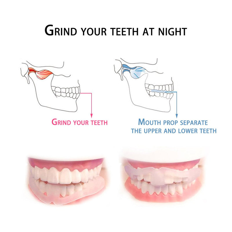 [Australia] - BKID Anti Grinding Teeth Protector Professional Dental Guard Dental Mouth Guard Stops Teeth Grinding 