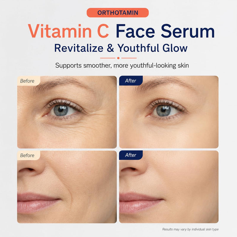 Vitamin C Ampoule,Orthotamin Vitamin C Serum,30ML/1.01floz (1pcs, 1) 1pcs 1 Fl Oz (Pack of 1)