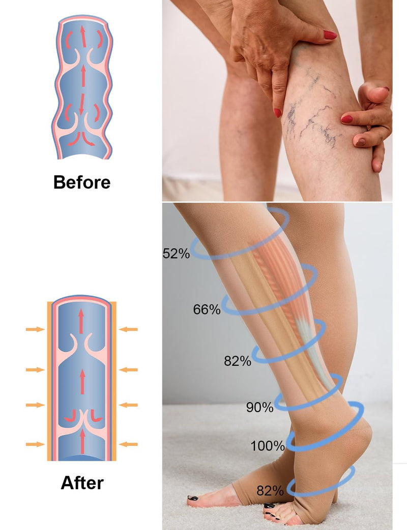 [Australia] - 2 pairs of medical compression stockings for women and men, 20-30 mmHg, class 2, open toe, graduated support, support stockings for varicose veins, edema, flight XXL, black and beige 