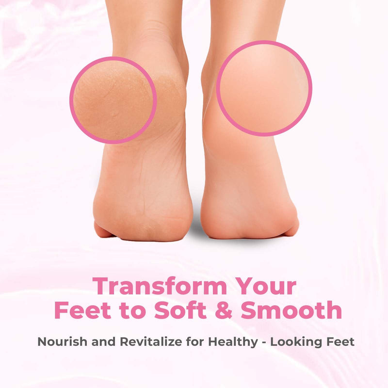 [Australia] - Foot Callus Remover with Foot File, Extra Strength Callus Remover Gel with Brush Head, Professional Dead Skin Removal for Feet, 8oz 