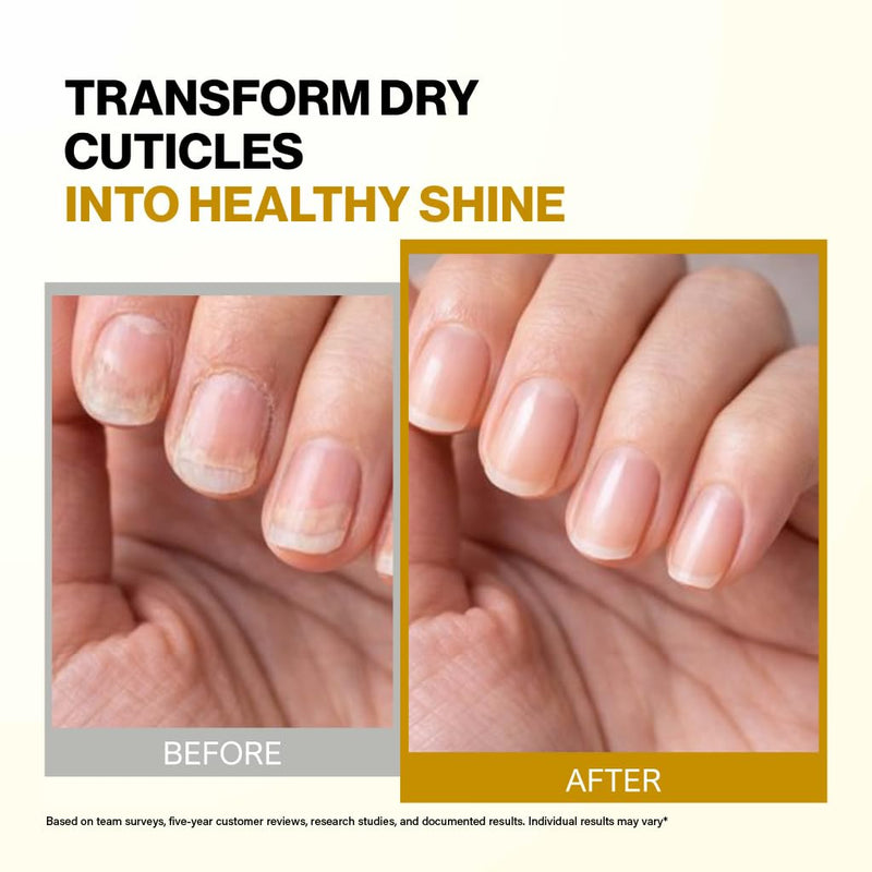 Bee Naturals Nail & Cuticle Oil 0.5 oz - Heals Cracked Nails & Rigid Cuticles, Deep Moisture with Avocado and Castor Oils 0.5 Fl Oz (Pack of 1)