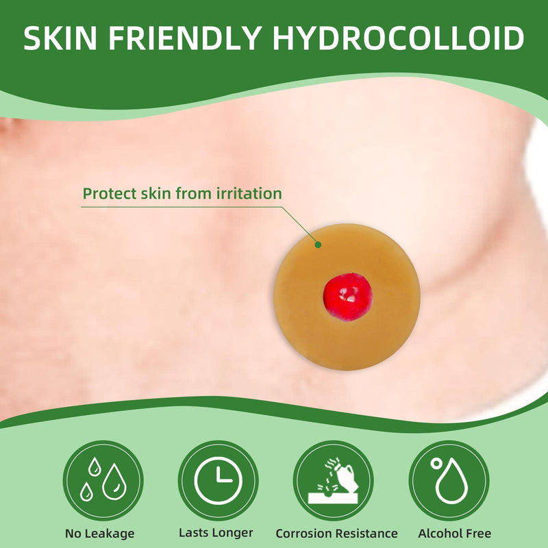 [Australia] - 10PCS Ostomy Barrier Rings, 2 / 4MM Moldable Ostomy Hydrocolloid Skin Extender Rings for Ostomy Bags (2mm-10pcs) 2mm-10pcs 