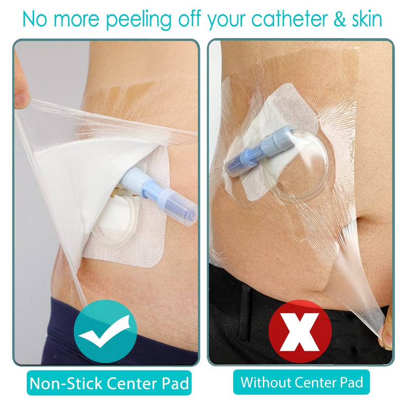 [Australia] - Waterproof Dialysis Catheter Shower Cover 10x12 Inch Protector with Non-Stick Center Pad PICC Line Bandage Patch Dressing Wounds Chest Port PD Peritoneal Accessories (Pack of 14) 10x12 Inch (Pack of 14) 