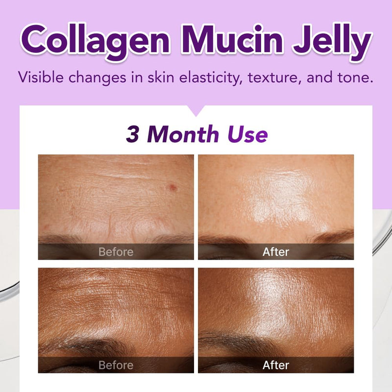 Glow, 1200mg Snail Mucin Supports Skin Elasticity, Collagen Peptides Jelly Stick, Kiwi Flavor, Biotin, Vitamin C, Hyaluronic Acid, Prebiotics, Korean Skin Care, 10 Sticks