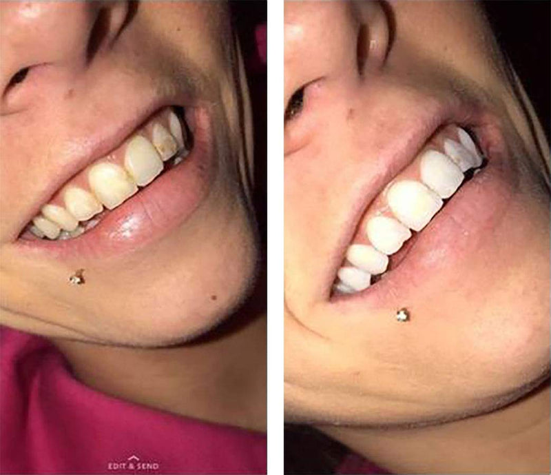 [Australia] - Color Wheel Teeth Whitener (Mint) Instantly Whitens Teeth. Easy to Use. 4 Ounce (Pack of 1) 