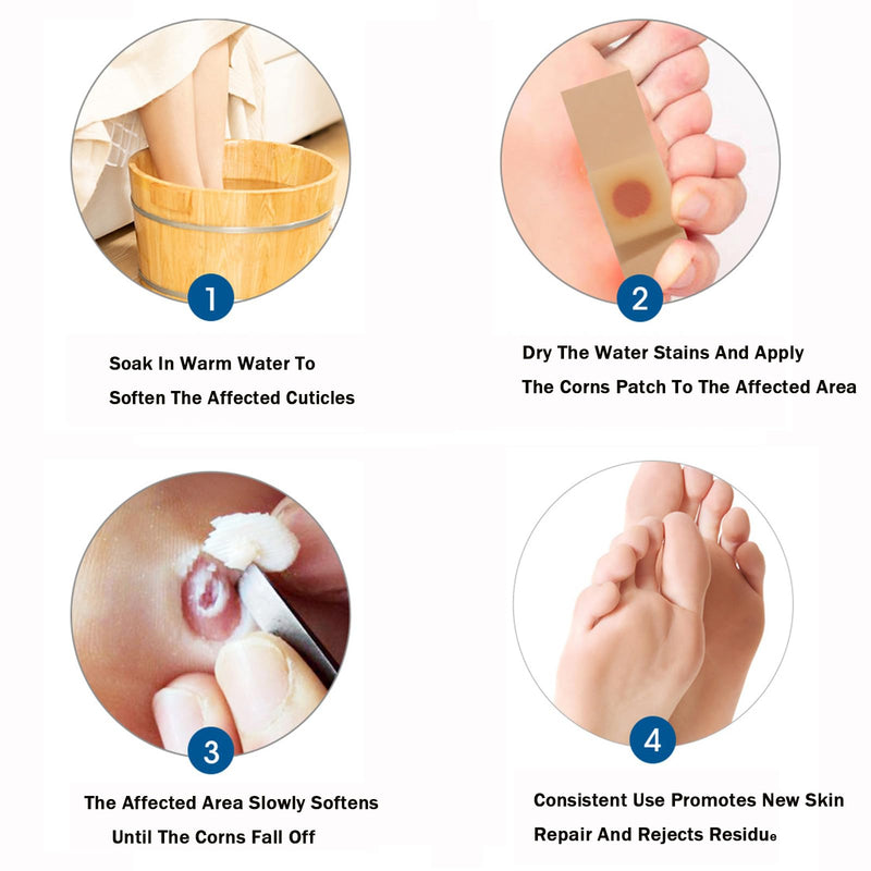 [Australia] - Corn Remover,Corn Removers for Feet Extra Strength,24 Pack Removes Corns Fast (24pcs) 24pcs 
