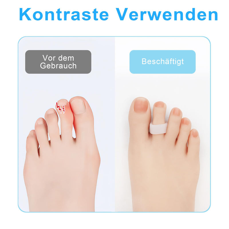 [Australia] - Scettar Silicone Hammer Toe Pads, 10 Pairs Hammer Toe Correction for Men/Women, Toe Protection Hammer Toe Pads for Pain Relief, Soft and Reusable Hammer Toe Correctors 